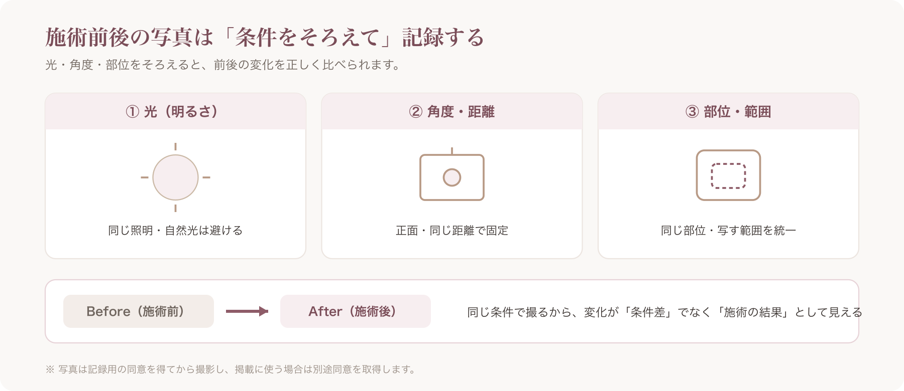 施術前後写真を統一して記録する方法の図