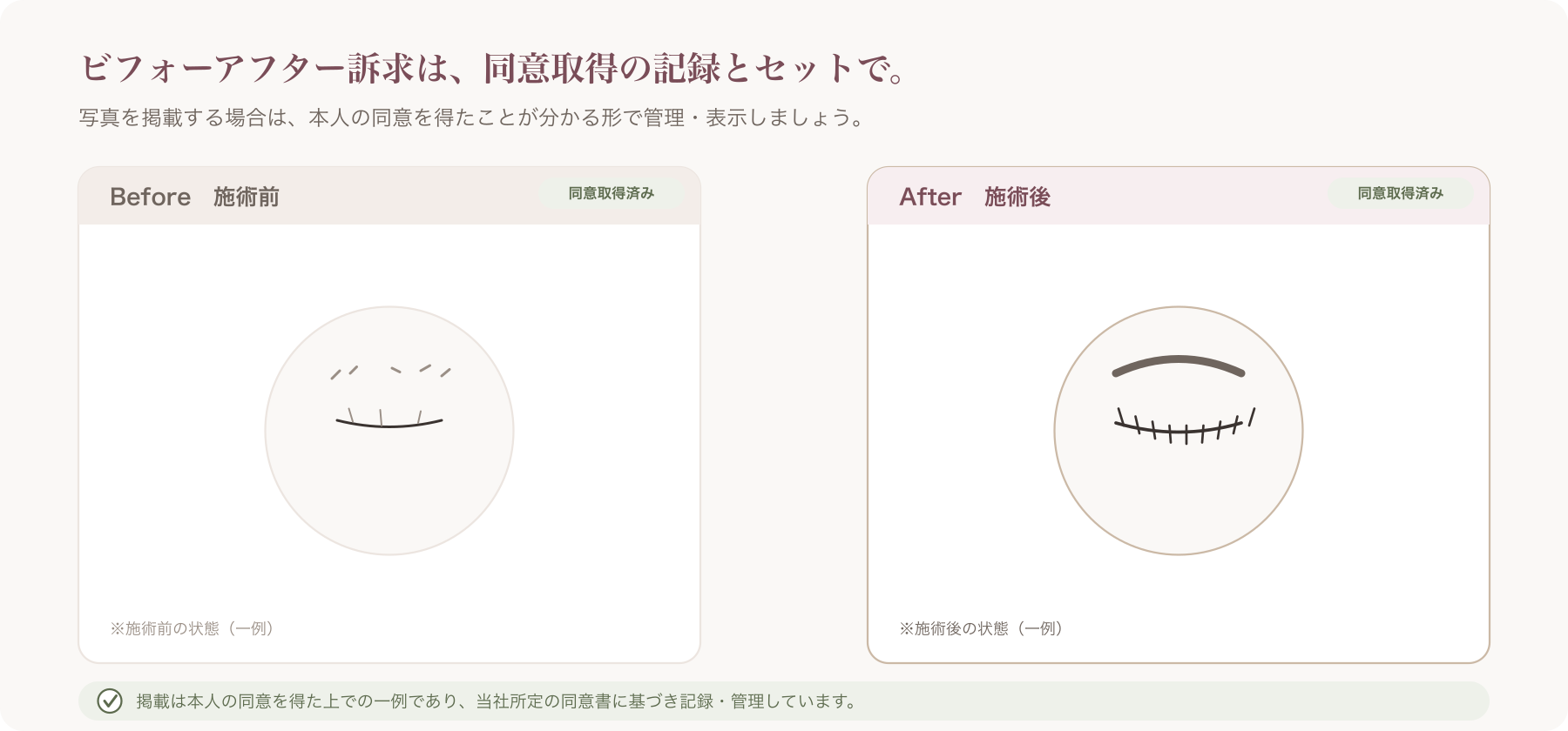 ビフォーアフターの訴求サンプル(同意取得済みであることが分かるキャプション付きのカット)