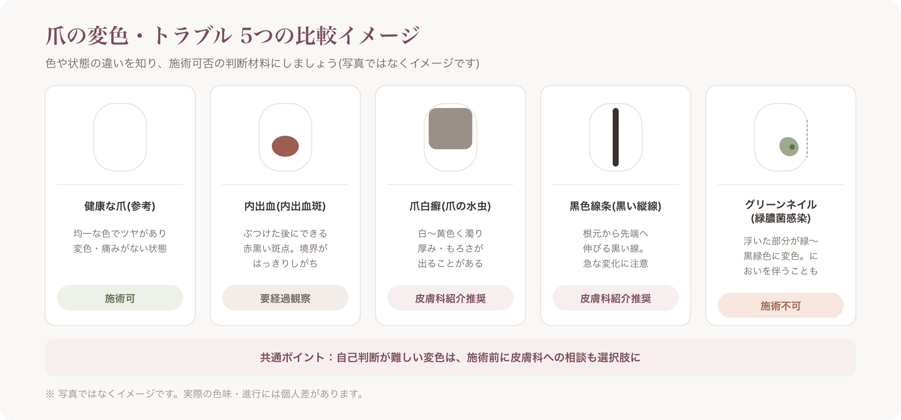 内出血・爪白癬・黒色線条・グリーンネイルなど5パターンの爪変色を並べた比較イメージ
